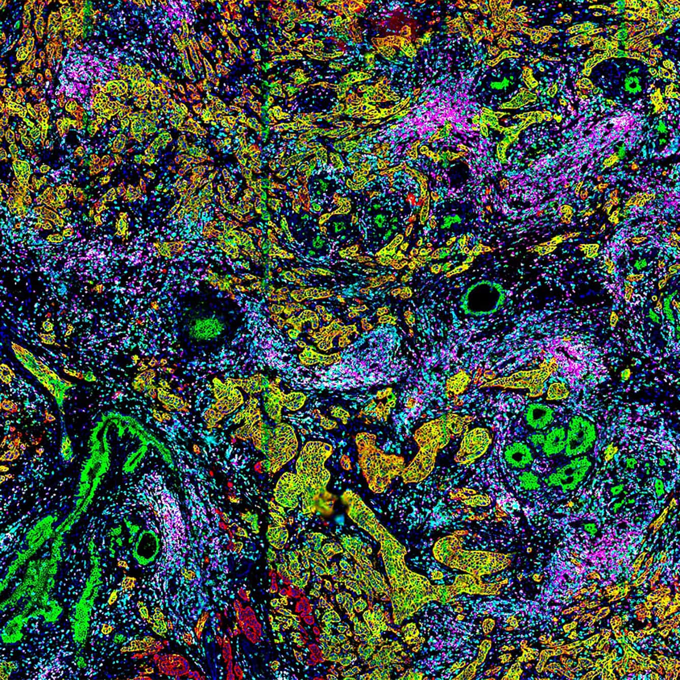 CellScape_Breast_Cancer_Multiplex