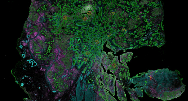 Exploring Spatial Transcriptomics